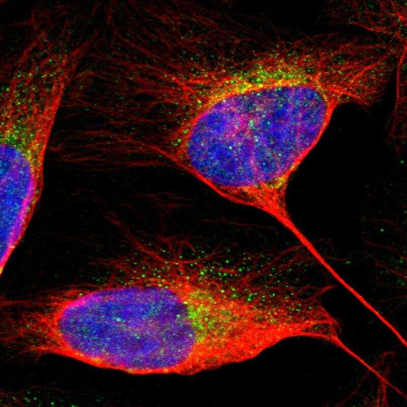 Alix Antibody - BSA Free Immunocytochemistry/ Immunofluorescence: Alix Antibody [NBP1-90201]