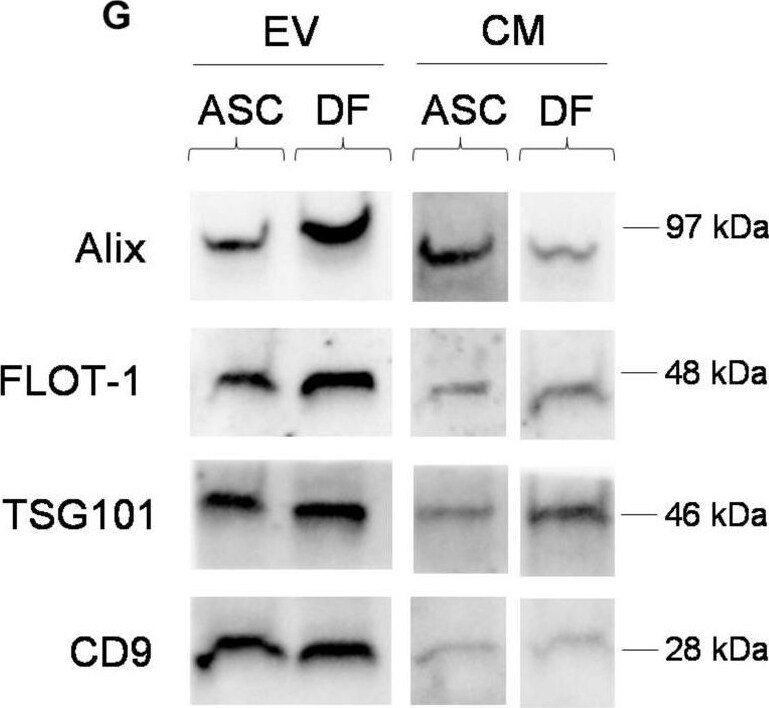 Alix Antibody - BSA Free