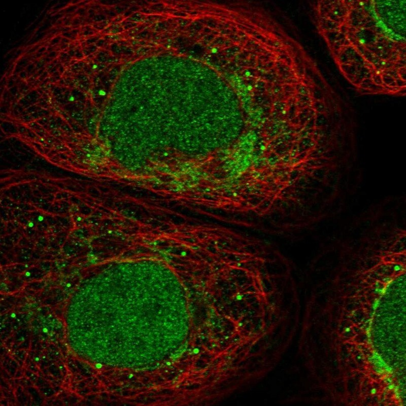 AKIP Antibody - BSA Free Immunocytochemistry/ Immunofluorescence: AKIP Antibody [NBP1-90202]