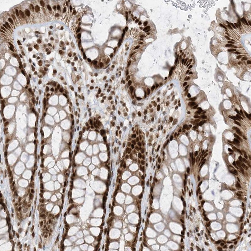 AKIP Antibody - BSA Free Immunohistochemistry: AKIP Antibody - BSA Free [NBP1-90202]