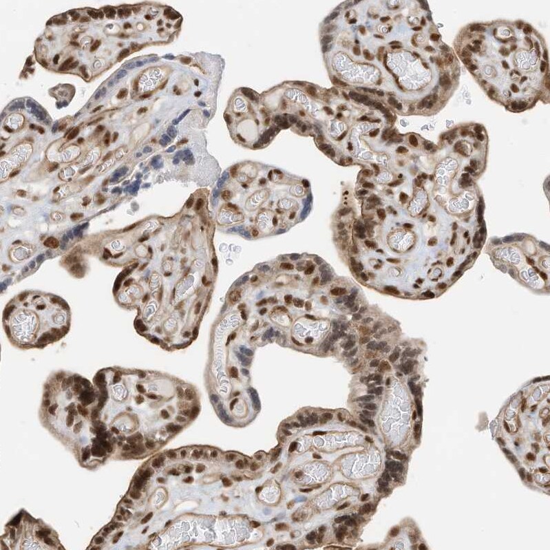 AKIP Antibody - BSA Free Immunohistochemistry: AKIP Antibody - BSA Free [NBP1-90202]