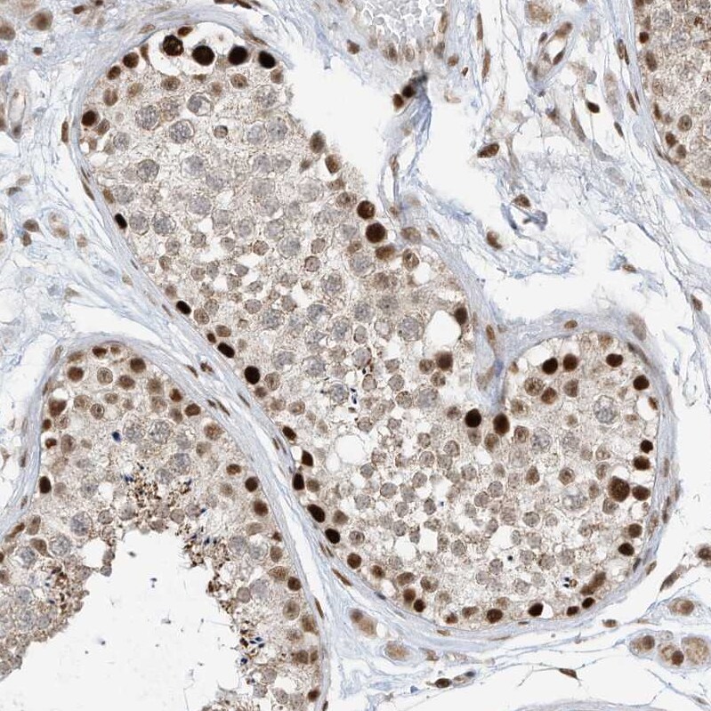 AKIP Antibody - BSA Free Immunohistochemistry: AKIP Antibody - BSA Free [NBP1-90202]