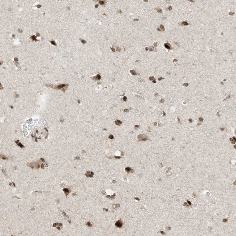 AKIP Antibody - BSA Free Immunohistochemistry: AKIP Antibody - BSA Free [NBP1-90202]