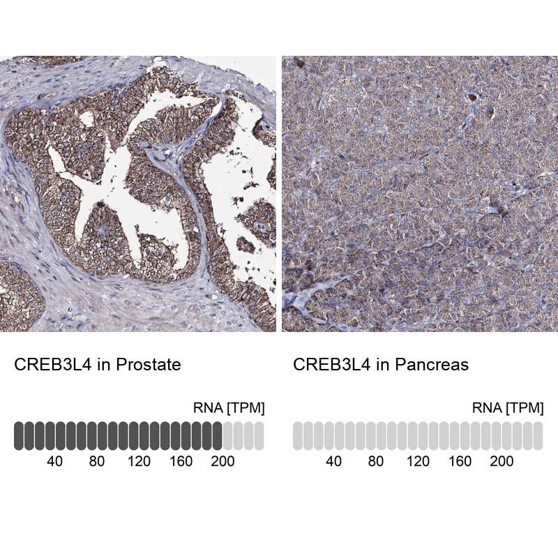 AIBZIP Antibody - BSA Free Immunohistochemistry: AIBZIP Antibody - BSA Free [NBP1-90205]