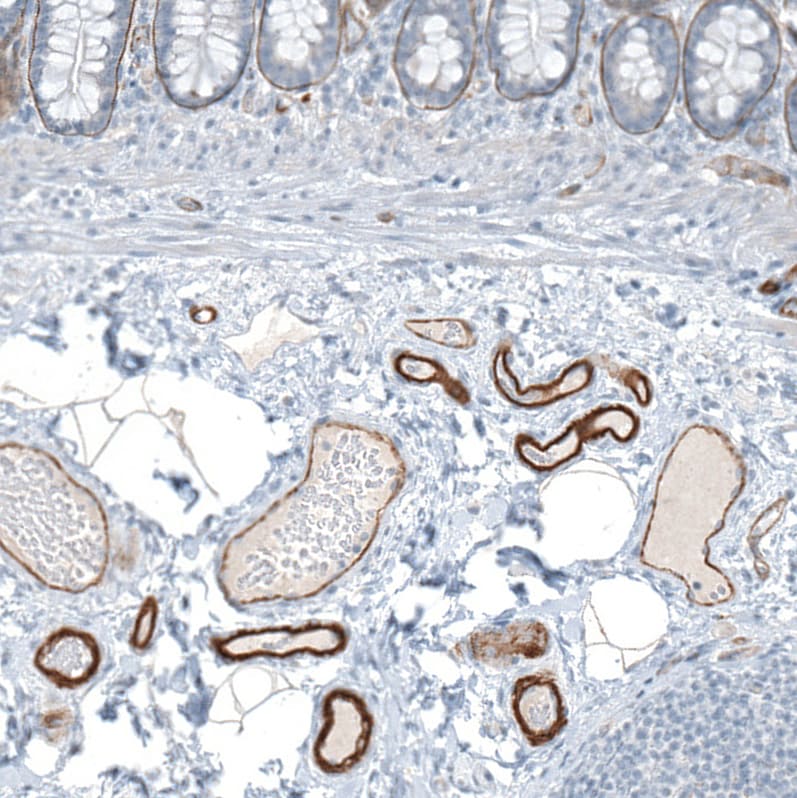 Agrin Antibody - BSA Free Immunohistochemistry-Paraffin: Agrin Antibody [NBP1-90209]