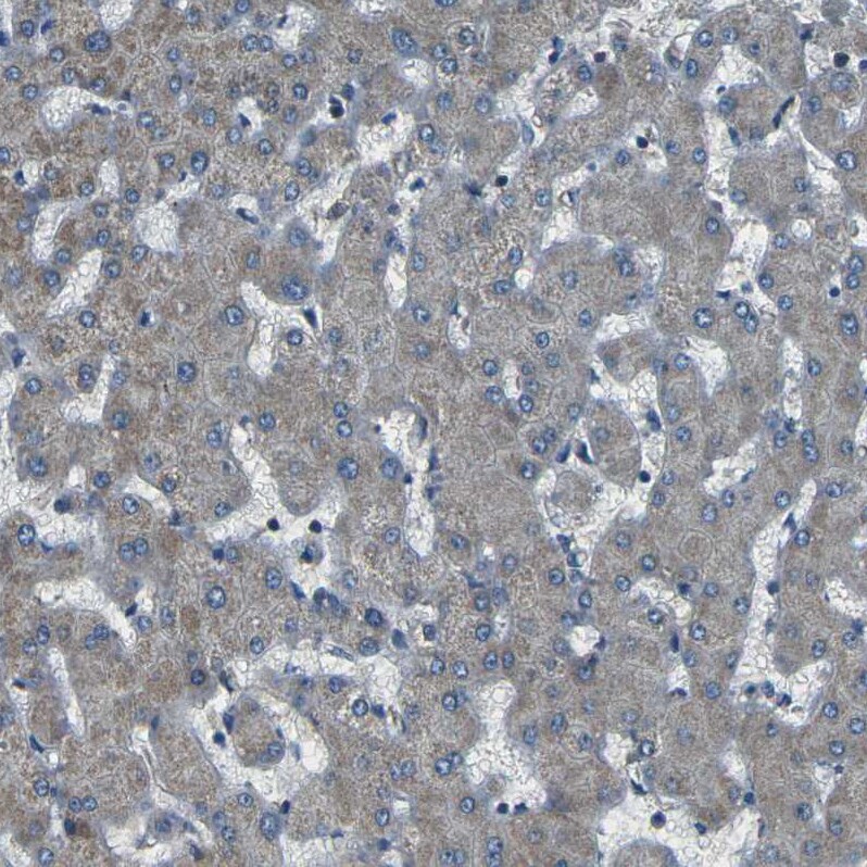 AFAP Antibody - BSA Free Immunohistochemistry: AFAP Antibody - BSA Free [NBP1-90216]