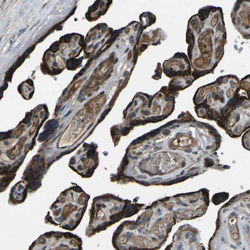 AFAP Antibody - BSA Free Immunohistochemistry: AFAP Antibody - BSA Free [NBP1-90216]