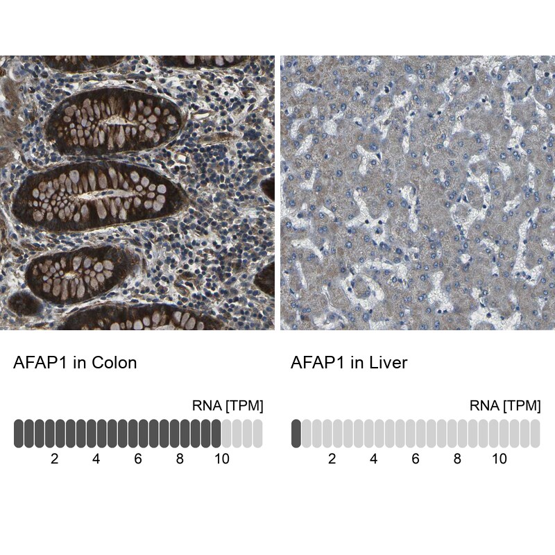 AFAP Antibody - BSA Free Immunohistochemistry: AFAP Antibody - BSA Free [NBP1-90216]