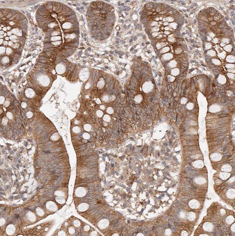 Afadin/AF-6 Antibody - BSA Free Immunohistochemistry-Paraffin: Afadin/AF-6 Antibody [NBP1-90218]