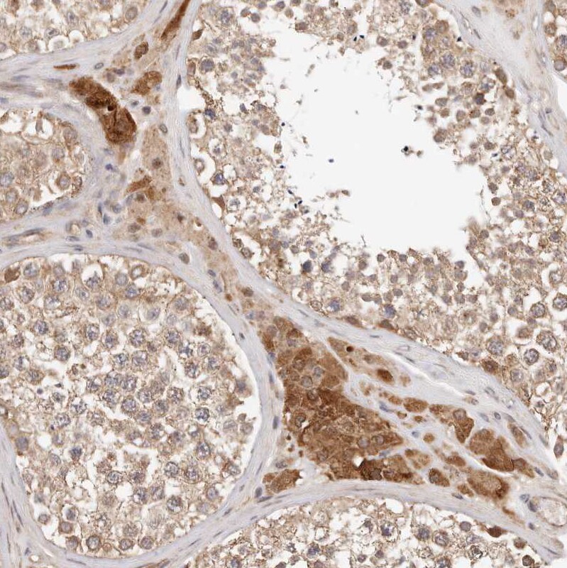 Afadin/AF-6 Antibody - BSA Free Immunohistochemistry-Paraffin: Afadin/AF-6 Antibody [NBP1-90218]