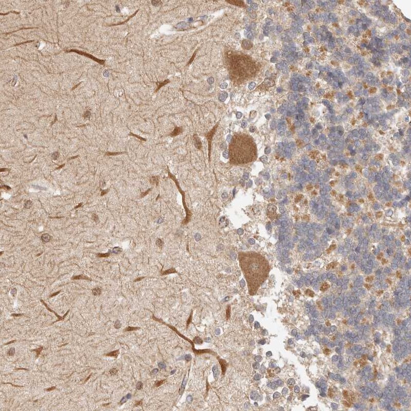 Afadin/AF-6 Antibody - BSA Free Immunohistochemistry-Paraffin: Afadin/AF-6 Antibody [NBP1-90218]