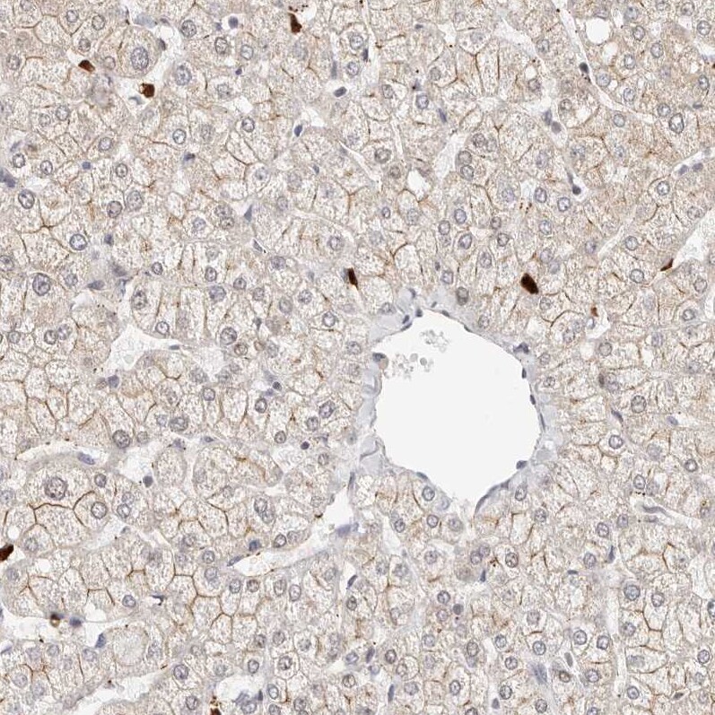 Afadin/AF-6 Antibody - BSA Free Immunohistochemistry: Afadin/AF-6 Antibody - BSA Free [NBP1-90219]