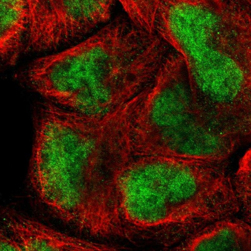 AF10 Antibody - BSA Free Immunocytochemistry/ Immunofluorescence: AF10 Antibody [NBP1-90222]