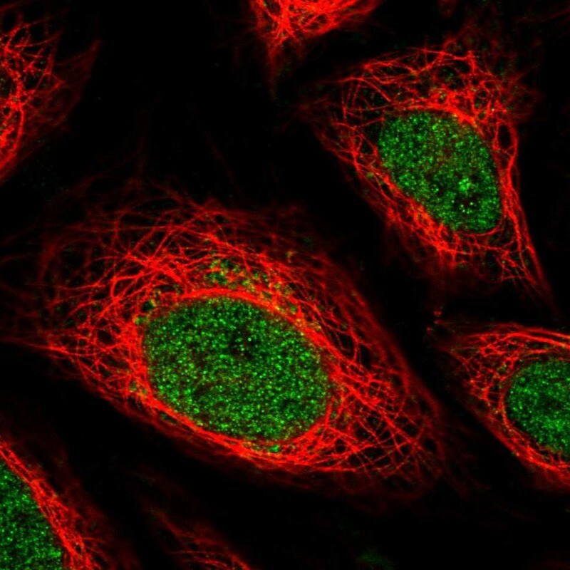 IFN-gamma R2 Antibody - BSA Free Immunocytochemistry/ Immunofluorescence: IFN-gamma R2 Antibody [NBP1-90223]
