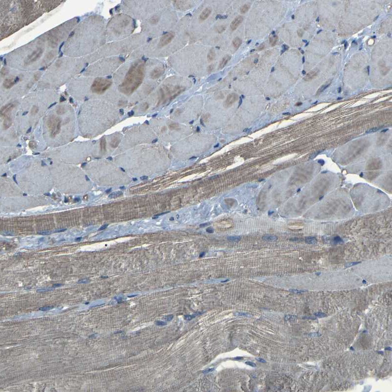 AE2 Antibody - BSA Free Immunohistochemistry: AE2 Antibody - BSA Free [NBP1-90225]