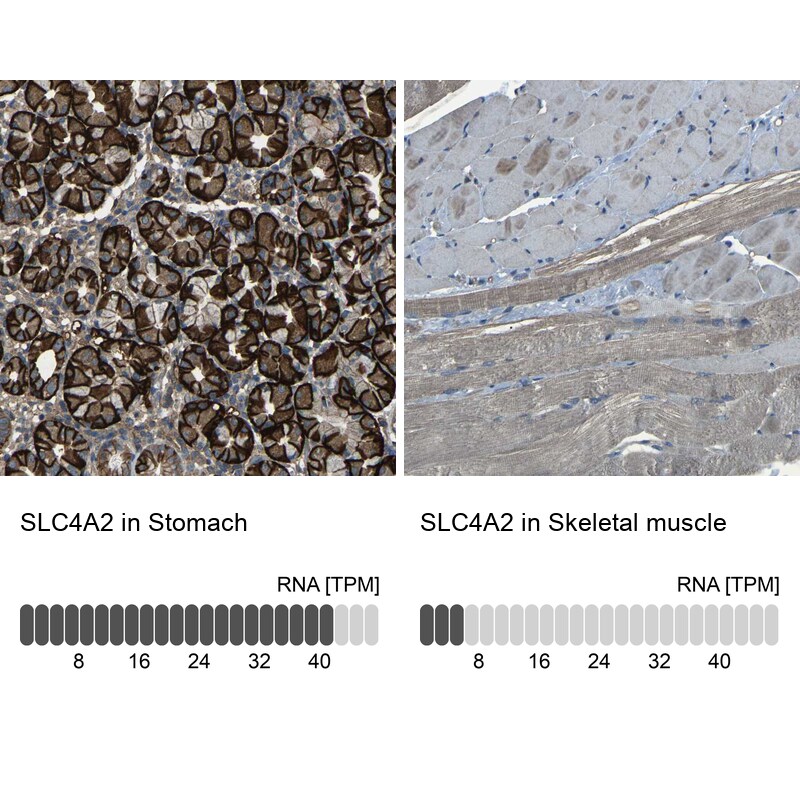 AE2 Antibody - BSA Free Immunohistochemistry: AE2 Antibody - BSA Free [NBP1-90225]