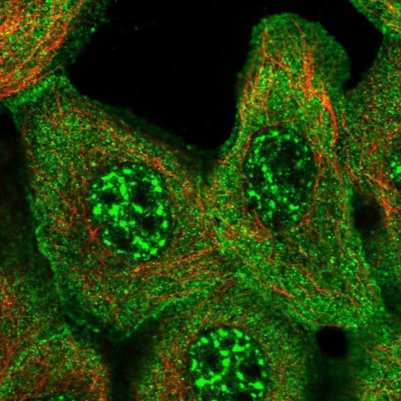 AE2 Antibody - BSA Free Immunocytochemistry/ Immunofluorescence: AE2 Antibody - BSA Free [NBP1-90225]