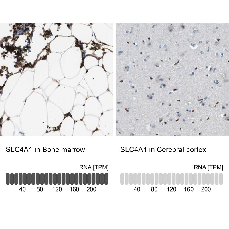 Band 3 Antibody - BSA Free Immunohistochemistry: Band 3 Antibody - BSA Free [NBP1-90226]