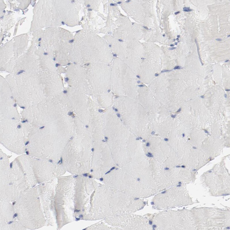 beta-2 Adrenergic R/ADRB2 Antibody - BSA Free Immunohistochemistry-Paraffin: beta-2 Adrenergic R/ADRB2 Antibody [NBP1-90227]