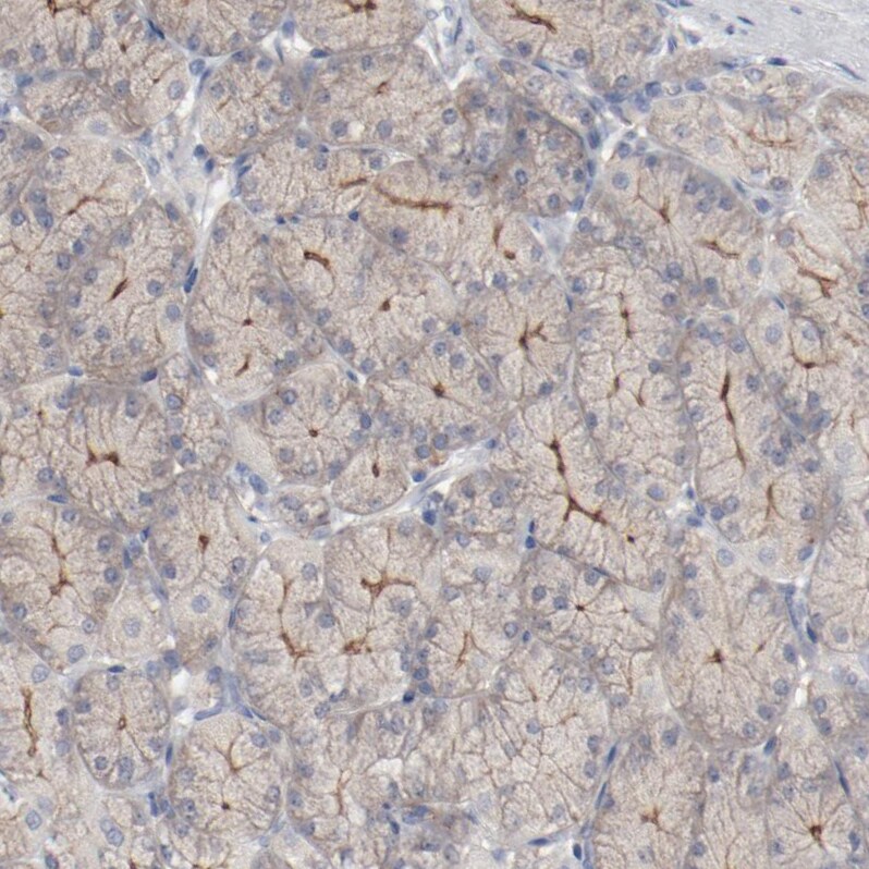 beta-2 Adrenergic R/ADRB2 Antibody - BSA Free Immunohistochemistry-Paraffin: beta-2 Adrenergic R/ADRB2 Antibody [NBP1-90227]