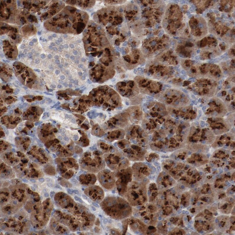 beta-2 Adrenergic R/ADRB2 Antibody - BSA Free Immunohistochemistry-Paraffin: beta-2 Adrenergic R/ADRB2 Antibody [NBP1-90227]