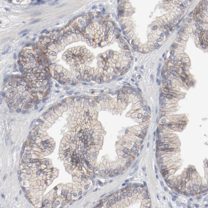 beta-2 Adrenergic R/ADRB2 Antibody - BSA Free Immunohistochemistry-Paraffin: beta-2 Adrenergic R/ADRB2 Antibody [NBP1-90227]