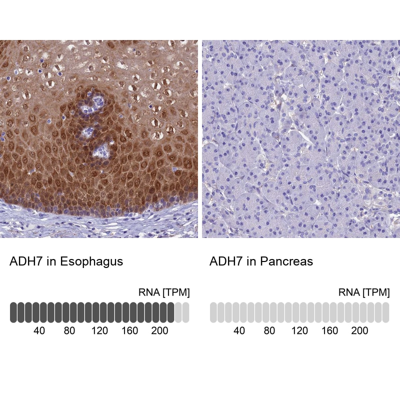 alcohol dehydrogenase 7 Antibody - BSA Free Immunohistochemistry: alcohol dehydrogenase 7 Antibody - BSA Free [NBP1-90232]