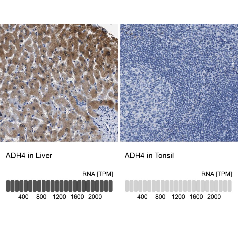alcohol dehydrogenase 4 Antibody - BSA Free Immunohistochemistry: alcohol dehydrogenase 4 Antibody - BSA Free [NBP1-90233]