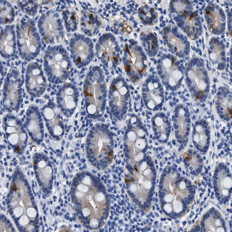 alcohol dehydrogenase 4 Antibody - BSA Free Immunohistochemistry: alcohol dehydrogenase 4 Antibody - BSA Free [NBP1-90233]