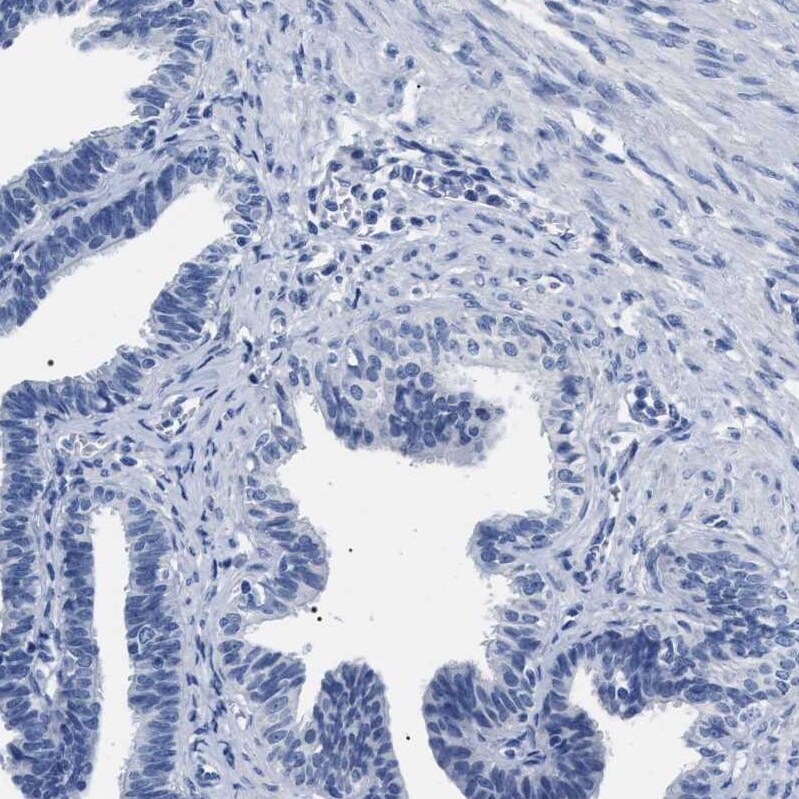 alcohol dehydrogenase 4 Antibody - BSA Free Immunohistochemistry: alcohol dehydrogenase 4 Antibody - BSA Free [NBP1-90233]