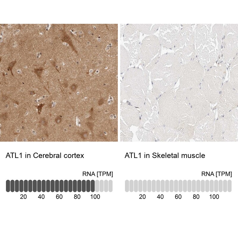 SPG3A Antibody - BSA Free Immunohistochemistry: SPG3A Antibody - BSA Free [NBP1-90234]