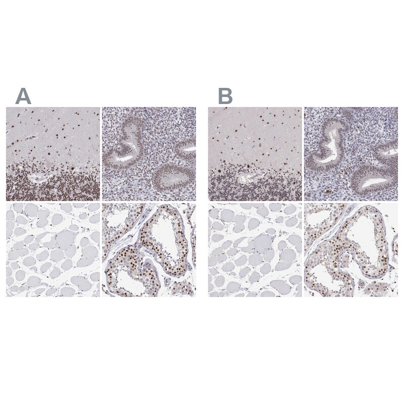 ADAR Antibody Immunohistochemistry-Paraffin: ADAR Antibody Antibody [NBP1-90242]