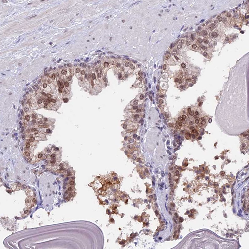 TADA3L Antibody - BSA Free Immunohistochemistry: TADA3L Antibody - BSA Free [NBP1-90243]