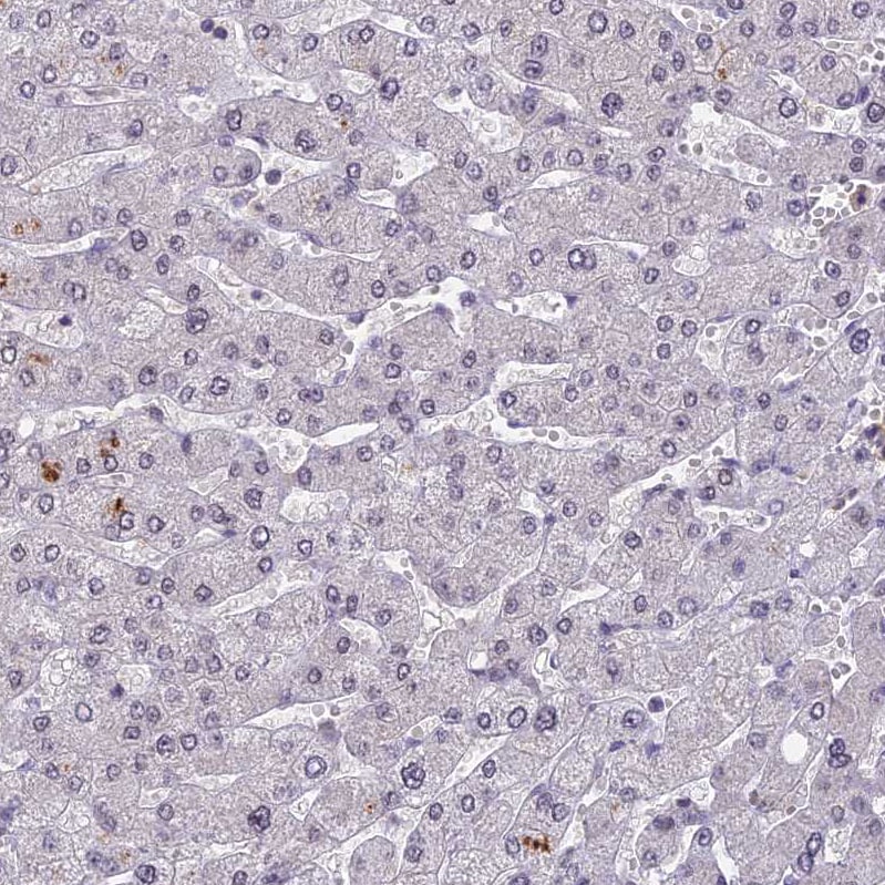TADA3L Antibody - BSA Free Immunohistochemistry: TADA3L Antibody - BSA Free [NBP1-90243]