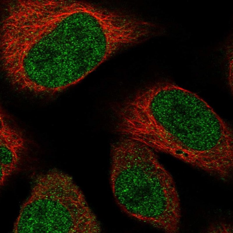 TADA3L Antibody - BSA Free Immunocytochemistry/ Immunofluorescence: TADA3L Antibody - BSA Free [NBP1-90243]