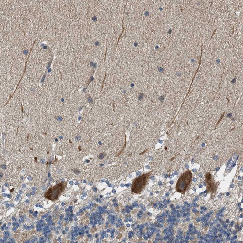 Piccolo Antibody - BSA Free Immunohistochemistry: Piccolo Antibody - BSA Free [NBP1-90251]