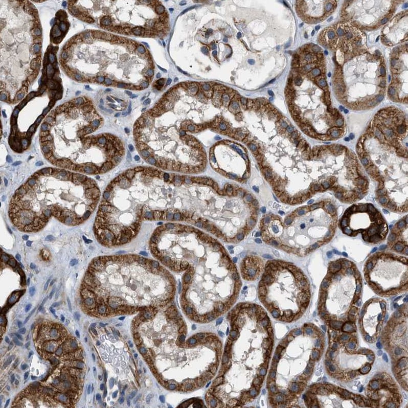 Piccolo Antibody - BSA Free Immunohistochemistry: Piccolo Antibody - BSA Free [NBP1-90251]