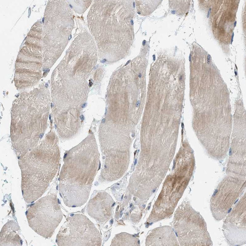 Piccolo Antibody - BSA Free Immunohistochemistry: Piccolo Antibody - BSA Free [NBP1-90251]