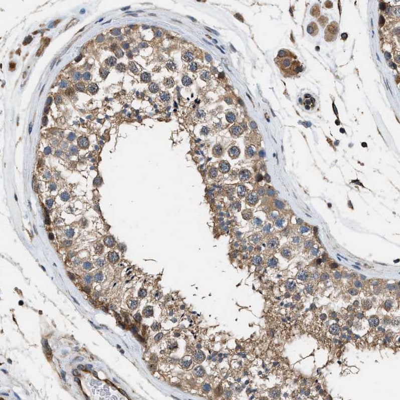 Piccolo Antibody - BSA Free Immunohistochemistry: Piccolo Antibody - BSA Free [NBP1-90251]