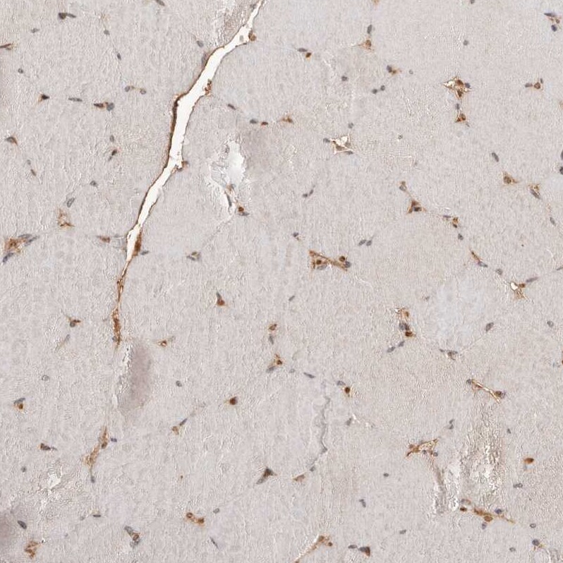 NCOA3/AIB1 Antibody - BSA Free Immunohistochemistry: NCOA3/AIB1 Antibody - BSA Free [NBP1-90256]