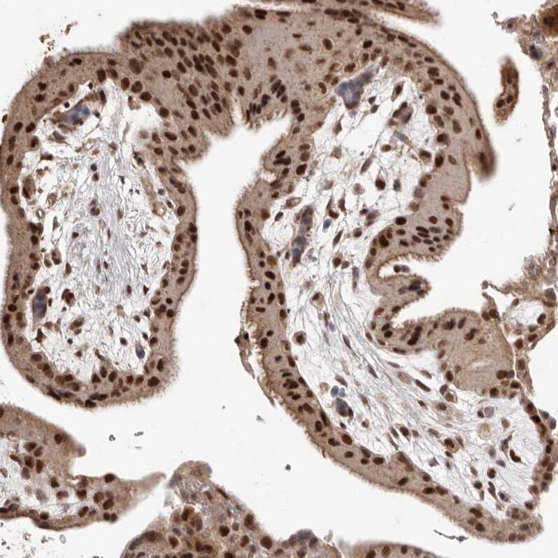 NCOA3/AIB1 Antibody - BSA Free Immunohistochemistry: NCOA3/AIB1 Antibody - BSA Free [NBP1-90256]