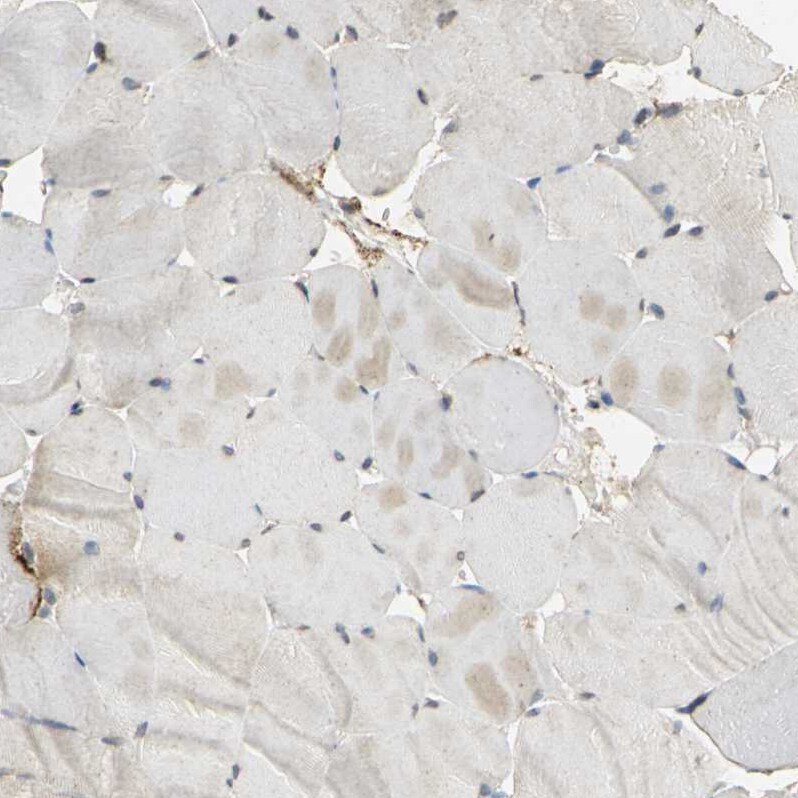 FACL4 Antibody - BSA Free Immunohistochemistry: FACL4 Antibody - BSA Free [NBP1-90258]