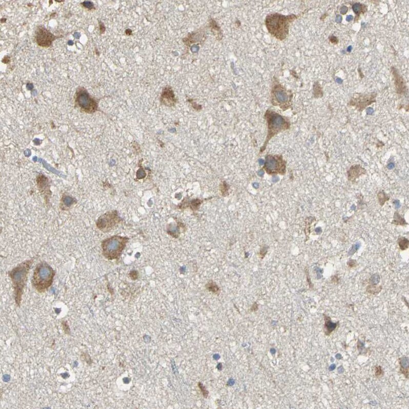 FACL4 Antibody - BSA Free Immunohistochemistry: FACL4 Antibody - BSA Free [NBP1-90258]