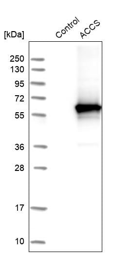 PHACS Antibody - BSA Free Western Blot: PHACS Antibody - BSA Free [NBP1-90259]