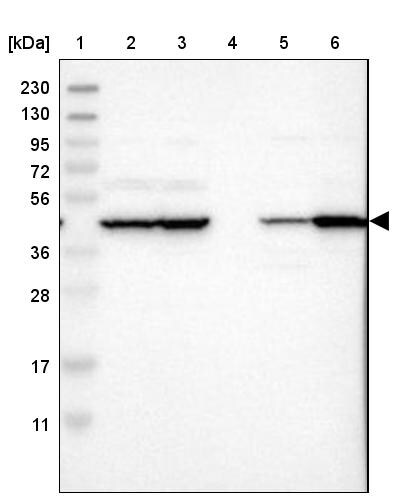 PHACS Antibody - BSA Free Western Blot: PHACS Antibody - BSA Free [NBP1-90260]