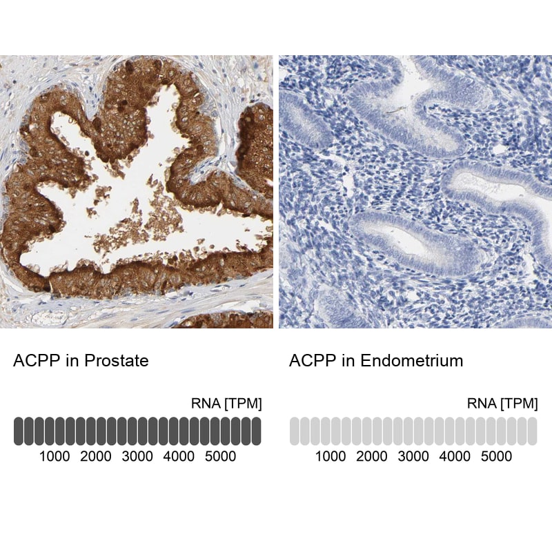 Prostatic Acid Phosphatase/ACPP Antibody - BSA Free Immunohistochemistry: Prostatic Acid Phosphatase/ACPP Antibody - BSA Free [NBP1-90263]