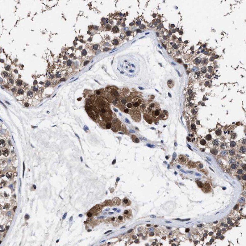 ATP Citrate Lyase Antibody - BSA Free Immunohistochemistry-Paraffin: ATP Citrate Lyase Antibody [NBP1-90266]
