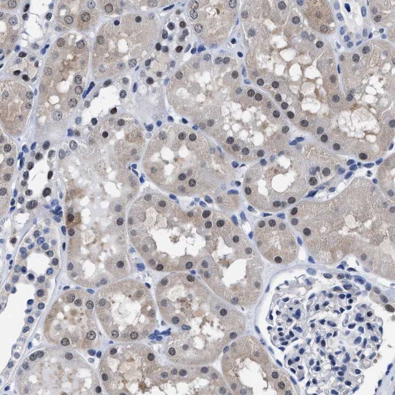 ATP Citrate Lyase Antibody - BSA Free Immunohistochemistry-Paraffin: ATP Citrate Lyase Antibody [NBP1-90266]