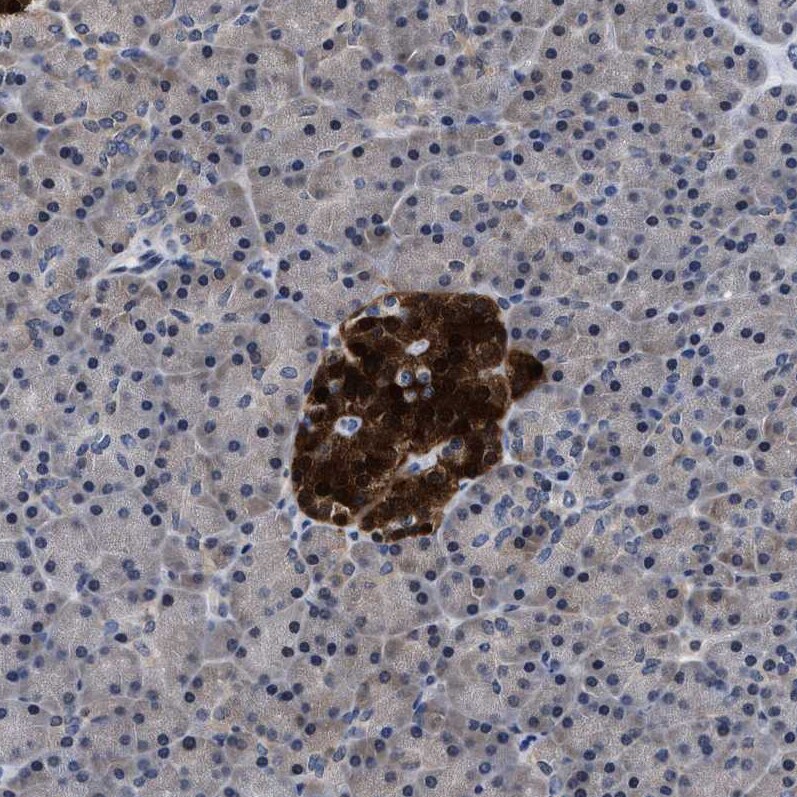 ATP Citrate Lyase Antibody - BSA Free Immunohistochemistry-Paraffin: ATP Citrate Lyase Antibody [NBP1-90266]