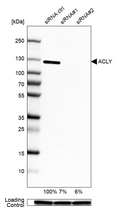 ATP Citrate Lyase Antibody - BSA Free Western Blot: ATP Citrate Lyase Antibody - BSA Free [NBP1-90266]